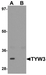 Western blot analysis of TYW3 in A549 cell lysate with TYW3 antibody at 1 µg/mL in (A) the absence and (B) the presence of blocking peptide.