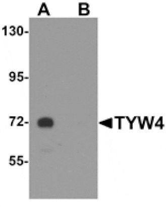 Western blot - TYW4 Antibody from Signalway Antibody (25317) - Antibodies.com