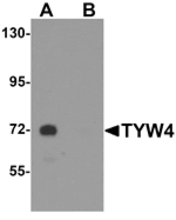 Western blot - TYW4 Antibody from Signalway Antibody (25317) - Antibodies.com