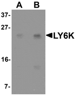 Western blot analysis of LY6K in HeLa cell lysate with LY6K antibody at (A) 1 and (B) 2 µg/mL.