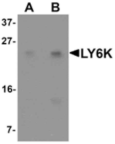 Western blot - LY6K Antibody from Signalway Antibody (25338) - Antibodies.com