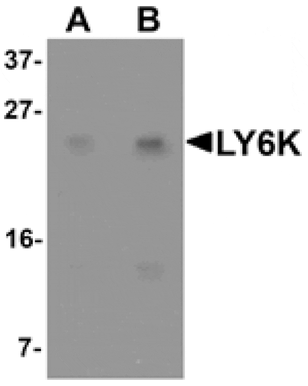 Western blot - LY6K Antibody from Signalway Antibody (25338) - Antibodies.com