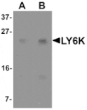 Western blot - LY6K Antibody from Signalway Antibody (25338) - Antibodies.com