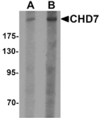 Western blot - CHD7 Antibody from Signalway Antibody (25340) - Antibodies.com