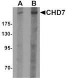 Western blot - CHD7 Antibody from Signalway Antibody (25340) - Antibodies.com