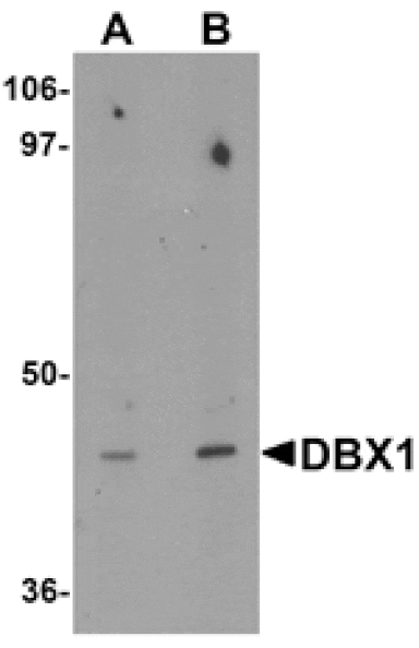 Western blot - DBX1 Antibody from Signalway Antibody (25347) - Antibodies.com