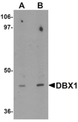 Western blot - DBX1 Antibody from Signalway Antibody (25347) - Antibodies.com