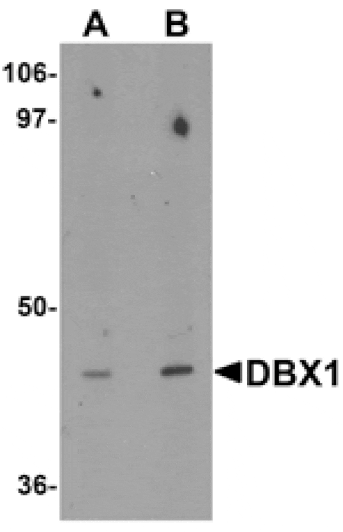 Western blot - DBX1 Antibody from Signalway Antibody (25347) - Antibodies.com