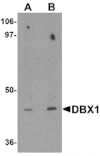 Western blot - DBX1 Antibody from Signalway Antibody (25347) - Antibodies.com