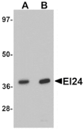 Western blot - EI24 Antibody from Signalway Antibody (25356) - Antibodies.com