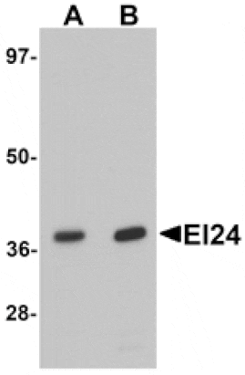 Western blot - EI24 Antibody from Signalway Antibody (25356) - Antibodies.com