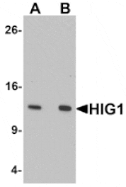 Western blot - HIG1 Antibody from Signalway Antibody (25357) - Antibodies.com