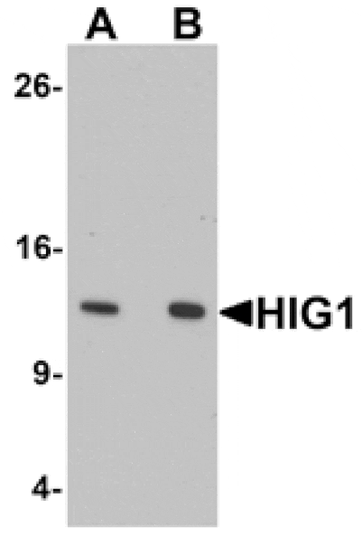 Western blot - HIG1 Antibody from Signalway Antibody (25357) - Antibodies.com