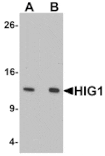 Western blot - HIG1 Antibody from Signalway Antibody (25357) - Antibodies.com