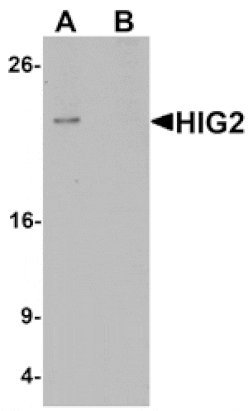 Western blot - HIG2 Antibody from Signalway Antibody (25358) - Antibodies.com