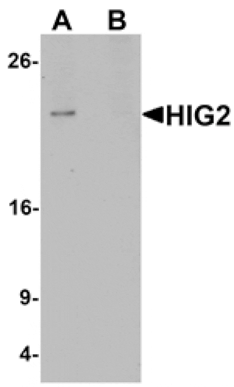 Western blot - HIG2 Antibody from Signalway Antibody (25358) - Antibodies.com