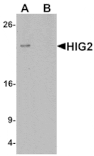 Western blot - HIG2 Antibody from Signalway Antibody (25358) - Antibodies.com