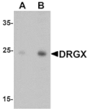 Western blot - DRGX Antibody from Signalway Antibody (25365) - Antibodies.com