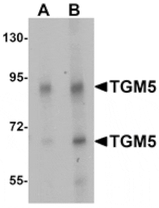 Western blot - TGM5 Antibody from Signalway Antibody (25370) - Antibodies.com