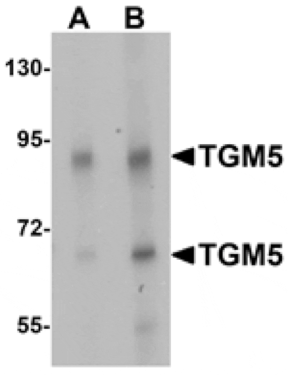 Western blot - TGM5 Antibody from Signalway Antibody (25370) - Antibodies.com