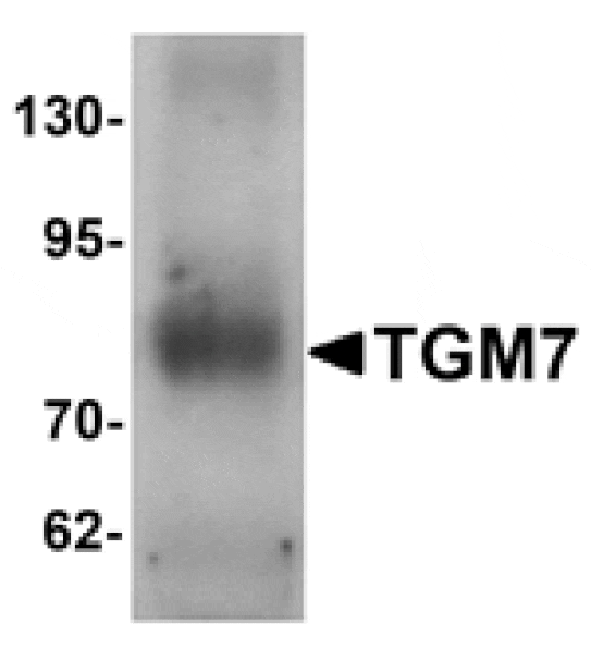 Western blot - TGM7 Antibody from Signalway Antibody (25372) - Antibodies.com