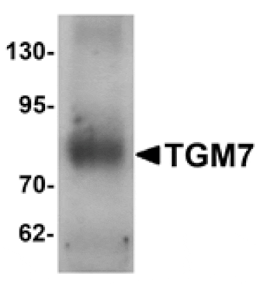 Western blot - TGM7 Antibody from Signalway Antibody (25372) - Antibodies.com