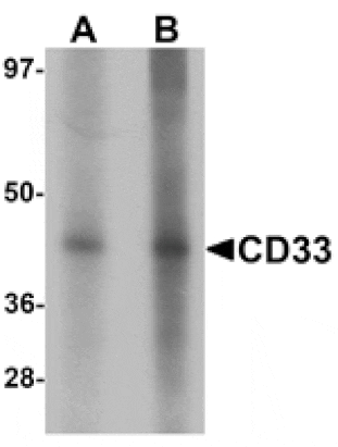 Western blot - CD33 Antibody from Signalway Antibody (25387) - Antibodies.com