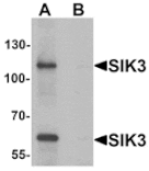Western blot - SIK3 Antibody from Signalway Antibody (25394) - Antibodies.com