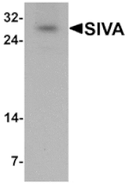 Western blot - SIVA Antibody from Signalway Antibody (25397) - Antibodies.com