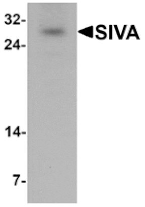 Western blot - SIVA Antibody from Signalway Antibody (25397) - Antibodies.com