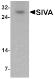 Western blot - SIVA Antibody from Signalway Antibody (25397) - Antibodies.com