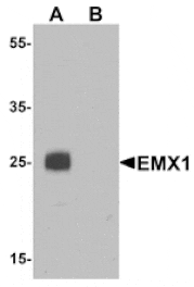Western blot - EMX1 Antibody from Signalway Antibody (25398) - Antibodies.com