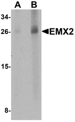 Western blot analysis of EMX2 in human lung tissue lysate with EMX2 antibody at (A) 1 and (B) 2 µg/mL.