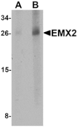 Western blot - EMX2 Antibody from Signalway Antibody (25399) - Antibodies.com