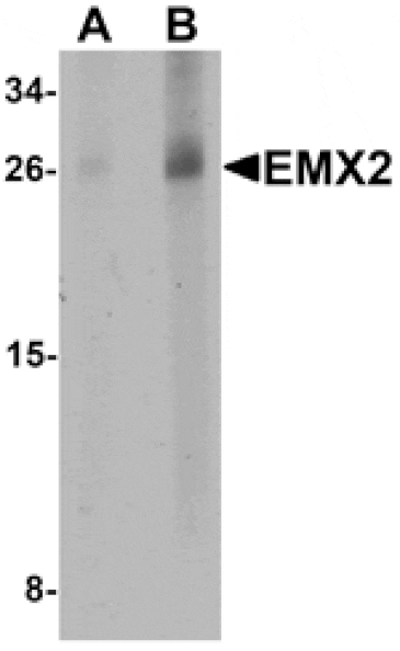 Western blot - EMX2 Antibody from Signalway Antibody (25399) - Antibodies.com
