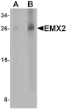 Western blot - EMX2 Antibody from Signalway Antibody (25399) - Antibodies.com
