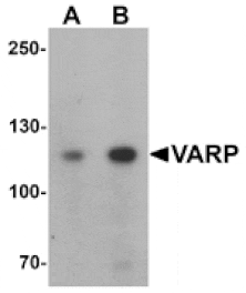 Western blot - VARP Antibody from Signalway Antibody (25417) - Antibodies.com