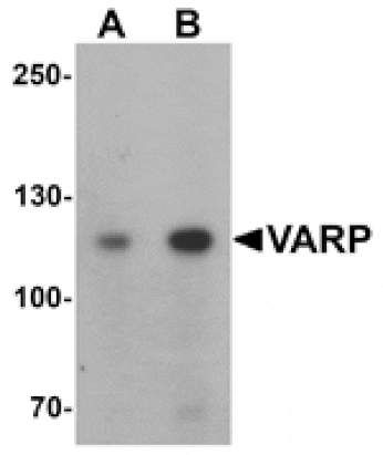 Western blot - VARP Antibody from Signalway Antibody (25417) - Antibodies.com