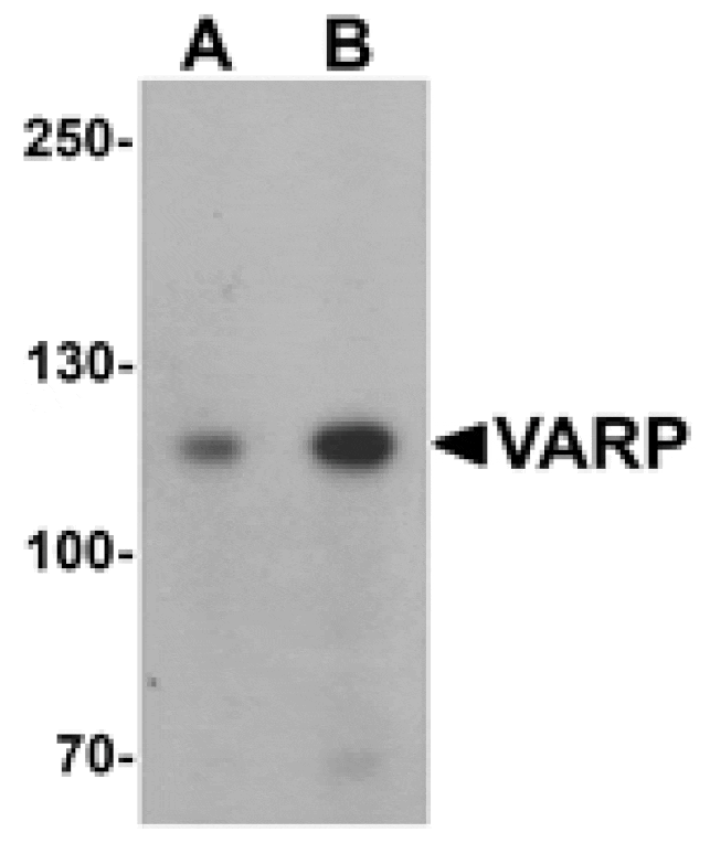 Western blot - VARP Antibody from Signalway Antibody (25417) - Antibodies.com