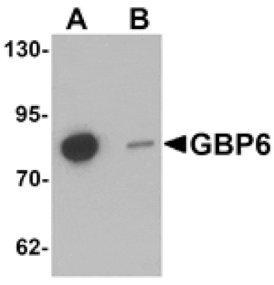 Western blot - GBP6 Antibody from Signalway Antibody (25422) - Antibodies.com