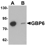 Western blot - GBP6 Antibody from Signalway Antibody (25422) - Antibodies.com