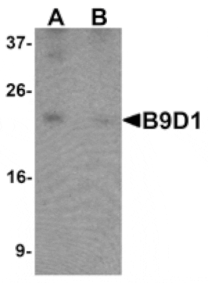 Western blot - B9D1 Antibody from Signalway Antibody (25424) - Antibodies.com