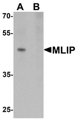 Western blot analysis of MLIP in 293 cell lysate with MLIP antibody at 1 µg/mL in (A) the absence and (B) the presence of blocking peptide.