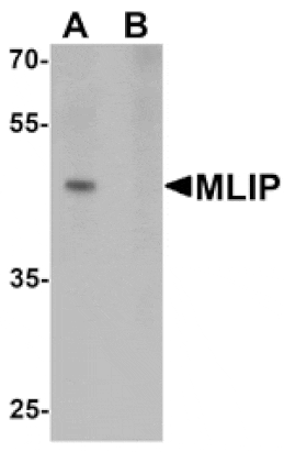 Western blot - MLIP Antibody from Signalway Antibody (25425) - Antibodies.com