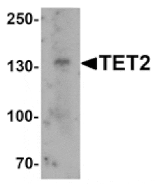 Western blot - TET2 Antibody from Signalway Antibody (25436) - Antibodies.com