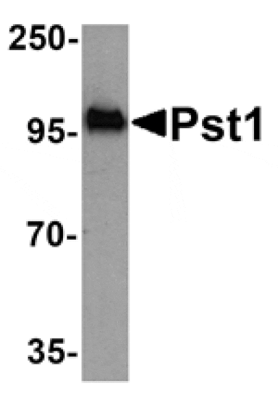 Western blot - Pst1 Antibody from Signalway Antibody (25443) - Antibodies.com