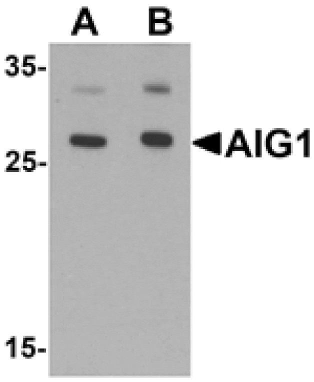 Western blot - AIG1 Antibody from Signalway Antibody (25469) - Antibodies.com