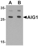 Western blot - AIG1 Antibody from Signalway Antibody (25469) - Antibodies.com