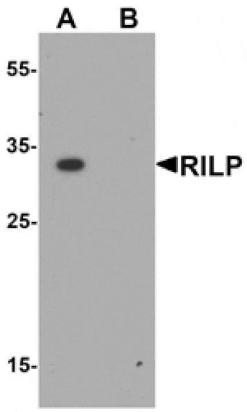 Western blot - RILP Antibody from Signalway Antibody (25472) - Antibodies.com