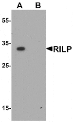 Western blot - RILP Antibody from Signalway Antibody (25472) - Antibodies.com
